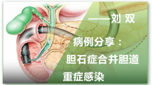 病例分享：胆石症合并胆道重症感染